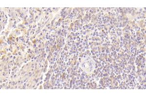 Detection of GM-CSF in Human Spleen Tissue using Polyclonal Antibody to Colony Stimulating Factor 2, Granulocyte Macrophage (GM-CSF) (GM-CSF 抗体  (AA 18-144))