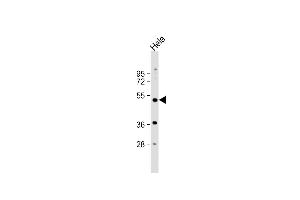 Western Blotting (WB) image for anti-Nuclear Receptor Subfamily 1, Group I, Member 2 (NR1I2) (AA 100-127) antibody (ABIN652618)