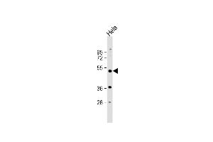 Anti-NR1I2 Antibody (Center) at 1:1000 dilution + Hela whole cell lysate Lysates/proteins at 20 μg per lane. (NR1I2 抗体  (AA 100-127))