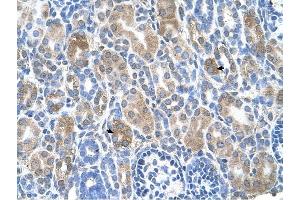 SLC36A3 antibody was used for immunohistochemistry at a concentration of 4-8 ug/ml to stain Epithelial cells of renal tubule (arrows) in Human Kidney. (SLC36A3 抗体)