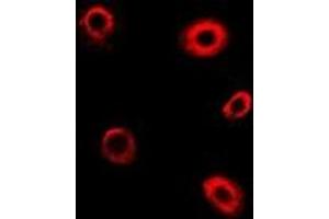 Immunofluorescent analysis of TBRG4 staining in Hela cells. (TBRG4 抗体)