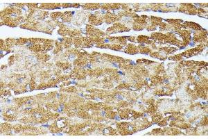 Immunohistochemistry of paraffin-embedded Mouse heart using TRAP1 Polyclonal Antibody at dilution of 1:100 (40x lens). (TRAP1 抗体)