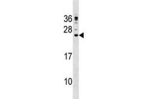 CAMP antibody western blot analysis in NCI-H292 lysate (Cathelicidin 抗体  (AA 123-152))
