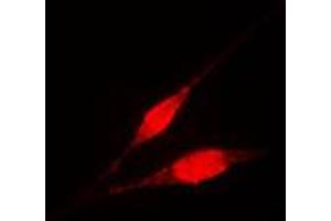 Immunofluorescent analysis of IKK gamma staining in HL60 cells. (IKBKG 抗体  (Center))