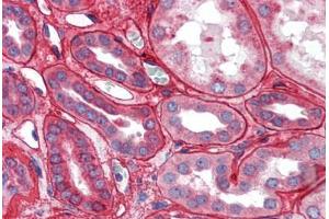 Kidney: Formalin-Fixed Paraffin-Embedded (FFPE) (Collagen IV 抗体)