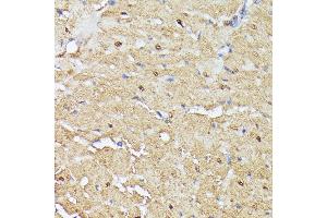 Immunohistochemistry of paraffin-embedded rat heart using TRIP4 antibody (ABIN7270824) at dilution of 1:100 (40x lens). (TRIP4 抗体  (AA 282-581))