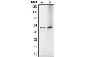 Western blot analysis of LASS4 expression in HeLa (A), Jurkat (B) whole cell lysates. (LASS4 抗体  (Center))