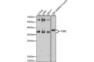 Western blot analysis of extracts of various cell lines, using TOB2 antibody. (TOB2 抗体)