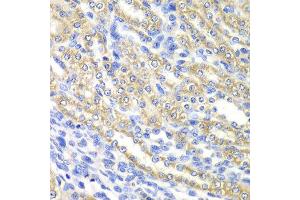 Immunohistochemistry of paraffin-embedded rat kidney using SURF1 antibody at dilution of 1:100 (x40 lens). (SURF1 抗体)