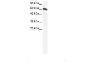 Image no. 1 for anti-Forkhead Box C2 (MFH-1, Mesenchyme Forkhead 1) (FOXC2) (AA 212-261) antibody (ABIN202667) (FOXC2 抗体  (AA 212-261))
