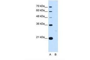 Image no. 1 for anti-14-3-3 zeta (YWHAZ) (C-Term) antibody (ABIN321366) (14-3-3 zeta 抗体  (C-Term))