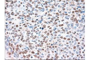 Immunohistochemical staining of paraffin-embedded liver tissue using anti-SIGLEC9mouse monoclonal antibody. (SIGLEC9 抗体)