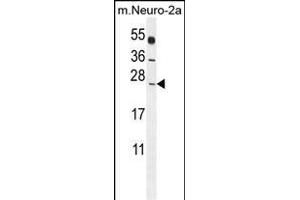 Western Blotting (WB) image for anti-Polymerase (RNA) II (DNA Directed) Polypeptide J, 13.3kDa (POLR2J) (AA 86-115), (C-Term) antibody (ABIN655247)