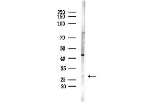 Western blot analysis of lysates from HUVEC cells(starvation,24h treatment), using TXNL6 Antibody at 1/1000 dilution.