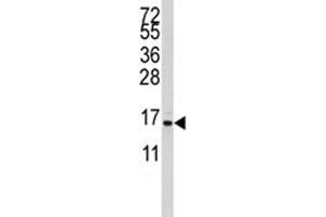 Western blot analysis of S100A11 antibody and CEM lysate. (S100A11 抗体  (AA 1-30))