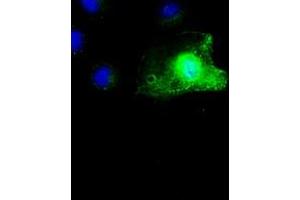 Image no. 4 for anti-SCY1-Like 3 (SCYL3) antibody (ABIN1500834)