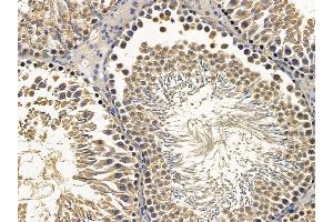 ABIN6256951 and ABIN6274866 at 1/100 staining rat testis tissue by IHC-P.