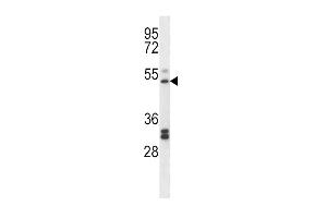 Western Blotting (WB) image for anti-Prostaglandin I2 (Prostacyclin) Synthase (PTGIS) (AA 210-238) antibody (ABIN5536968)