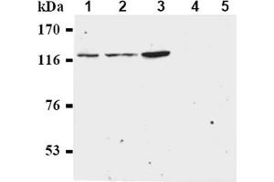 Western Blotting (WB) image for anti-Budding Uninhibited By Benzimidazoles 1 Homolog beta (Yeast) (BUB1B) antibody (ABIN567606) (BUB1B 抗体)