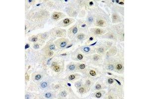 Immunohistochemical analysis of SSX5 staining in mouse liver formalin fixed paraffin embedded tissue section. (SSX5 抗体)
