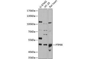 Western Blotting (WB) image for anti-Protein tyrosine Phosphatase, Receptor Type, R (PTPRR) (AA 240-400) antibody (ABIN6146471)