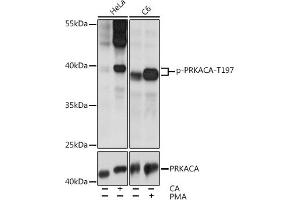 Western blot analysis of extracts of various cell lines, using Phospho-PKA C-alpha (PRKACA)-T197 pAb (ABIN6135290, ABIN6136202, ABIN6136203 and ABIN6225582) at 1:2000 dilution or PKA C-alpha (PRKACA) antibody (ABIN7269625). (PRKACA 抗体  (pThr197))