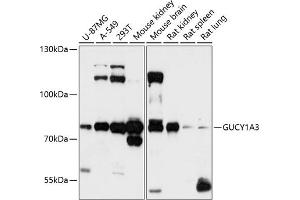 Western blot analysis of extracts of various cell lines, using GUCY1 antibody (ABIN6127969, ABIN6141533, ABIN6141534 and ABIN6216446) at 1:3000 dilution. (GUCY1A1 抗体  (AA 1-120))