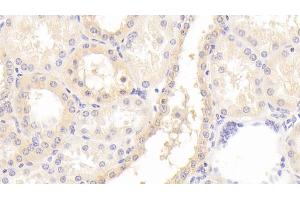 Immunohistochemistry (IHC) image for anti-Guanine Nucleotide Binding Protein (G Protein), beta Polypeptide 2 (GNB2) (AA 2-340) antibody (ABIN7443239)