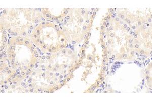 Detection of GNb2 in Human Kidney Tissue using Polyclonal Antibody to G Protein Beta 2 (GNb2) (GNB2 抗体  (AA 2-340))