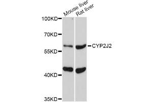 Western blot analysis of extracts of various cell lines, using CYP2J2 Antibody (ABIN2562107) at 1:1000 dilution.