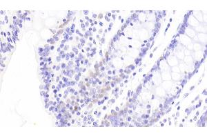 Immunohistochemistry (IHC) image for anti-Caudal Type Homeobox 2 (CDX2) (AA 1-313) antibody (ABIN7440836)
