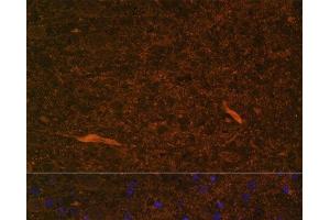 Immunofluorescence analysis of Rat brain using TEK Polyclonal Antibody at dilution of 1:100. (TEK 抗体)
