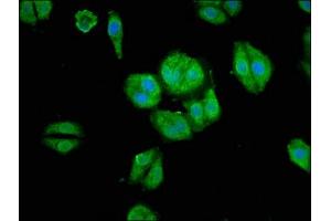 Immunofluorescence staining of HepG2 cells with ABIN7167935 at 1:66, counter-stained with DAPI. (ARHGAP18 抗体  (AA 389-577))