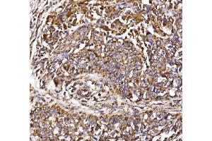 IHC analysis of MDH2 using anti-MDH2 antibody (ABIN7602618).