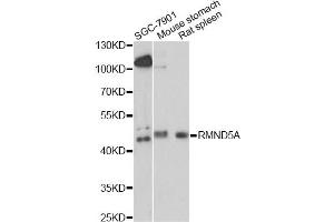 Western blot analysis of extracts of various cell lines, using RMND5A antibody. (RMND5A 抗体)