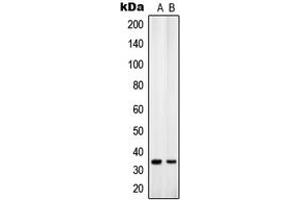 Western Blotting (WB) image for anti-Solute Carrier Family 25 (Mitochondrial Carrier, Adenine Nucleotide Translocator), Member 31 (SLC25A31) (Center) antibody (ABIN7298420)