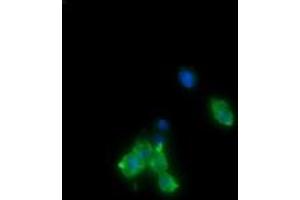 Image no. 2 for anti-Cancer/testis Antigen 1B (CTAG1B) antibody (ABIN1499898) (CTAG1B 抗体)