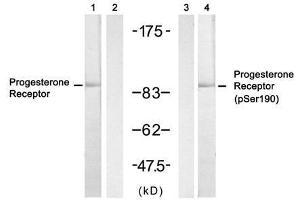 Western blot analysis of extract from SKOV3 cell untreated or treated with insulin, using Progesterone Receptor (Ab- 190) antibody (E021069, Lane 1 and 2) and Progesterone Receptor (phospho-Ser190) antibody (E011074, Lane 3 and 4). (Progesterone Receptor 抗体  (pSer190))