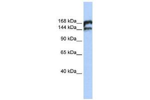 WB Suggested Anti-TOP2B  Antibody Titration: 0.