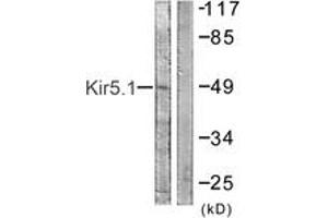 Western Blotting (WB) image for anti-Potassium Inwardly-Rectifying Channel, Subfamily J, Member 16 (KCNJ16) (AA 369-418) antibody (ABIN1532704)