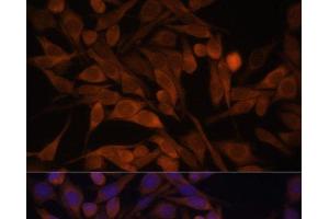 Immunofluorescence analysis of HeLa cells using CACYBP Polyclonal Antibody at dilution of 1:100. (CACYBP 抗体)