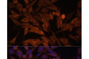 Immunofluorescence analysis of HeLa cells using CACYBP Polyclonal Antibody at dilution of 1:100. (CACYBP 抗体)