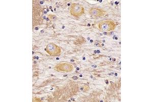 (ABIN388782 and ABIN2839114) staining TAU in Cynomolgus Monkey brain tissue sections by Immunohistochemistry (IHC-P - paraformaldehyde-fixed, paraffin-embedded sections). (tau 抗体  (C-Term))