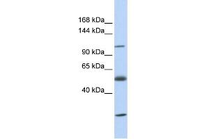 Western Blotting (WB) image for anti-Solute Carrier Family 39 (Zinc Transporter), Member 10 (SLC39A10) (N-Term) antibody (ABIN2781666)