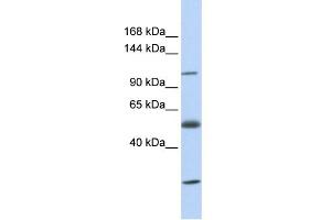 WB Suggested Anti-SLC39A10 Antibody Titration:  0.