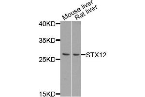 Western blot analysis of extract of mouse liver and rat liver cells, using STX12 antibody. (Syntaxin 12 抗体)