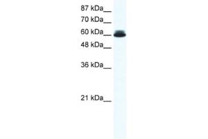 Western Blotting (WB) image for anti-DEAD (Asp-Glu-Ala-Asp) Box Polypeptide 27 (DDX27) antibody (ABIN2461352) (DDX27 抗体)