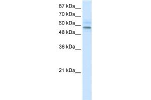 WB Suggested Anti-MGC4618 Antibody   Titration: 1. (TMEM175 抗体  (N-Term))