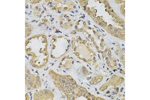 Immunohistochemistry of paraffin-embedded human kidney using N6AMT1 Antibody (ABIN5974334) at dilution of 1/100 (40x lens). (N6AMT1 抗体)