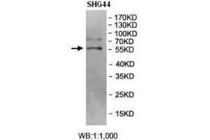 Western blot analysis of SHG44 cell Lysate using BRD9 Antibody. (BRD9 抗体  (AA 264-475))